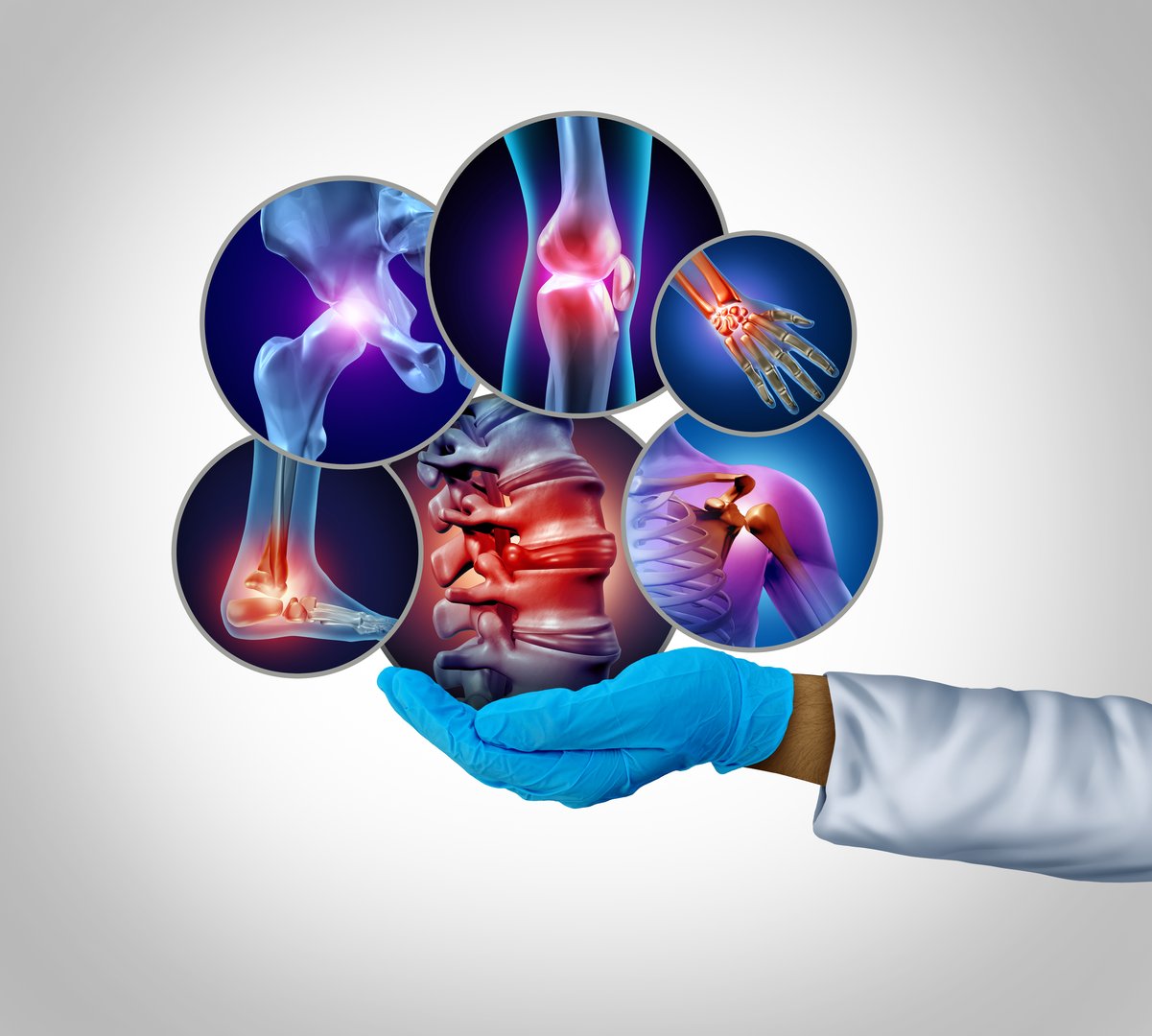 Joint Replacement