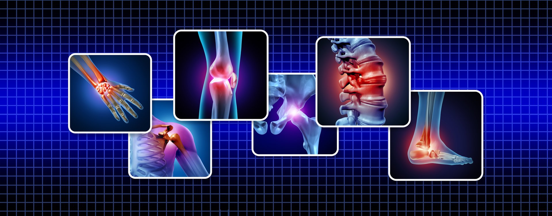 Spine Surgery